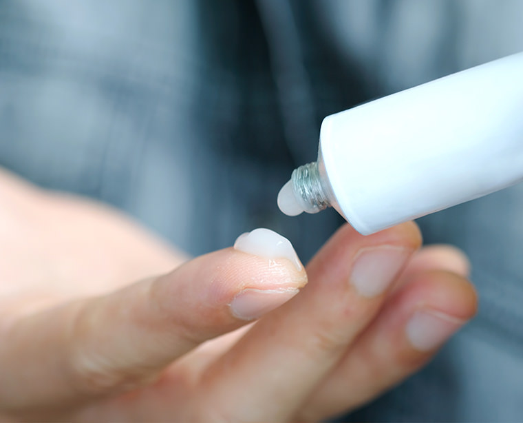 Do cortisone creams have side effects?