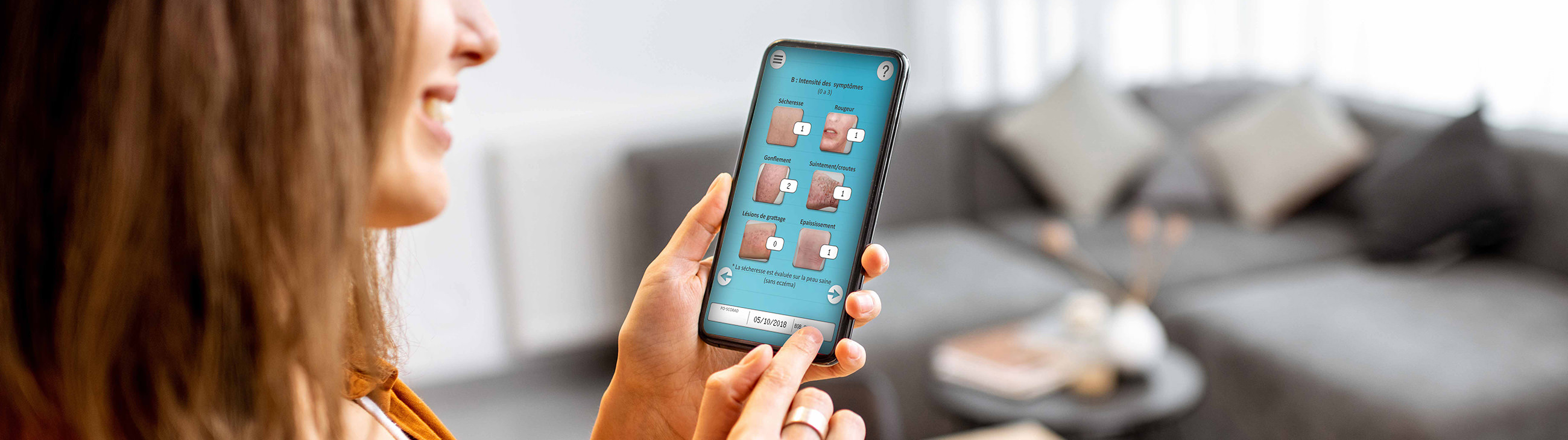 L'appli qui calcule la sévérité de votre eczéma : PO-SCORAD