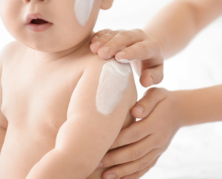 eczema en los bebés