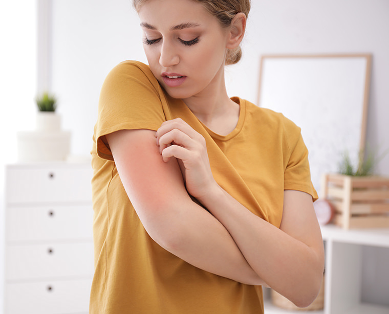 What complications are associated with atopic eczema?