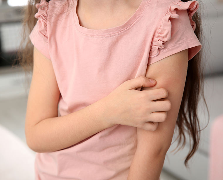Comprender todo sobre el eczema en los niños