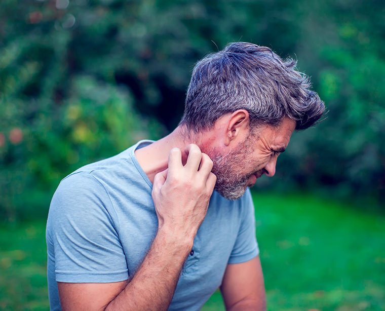 O eczema é uma alergia?