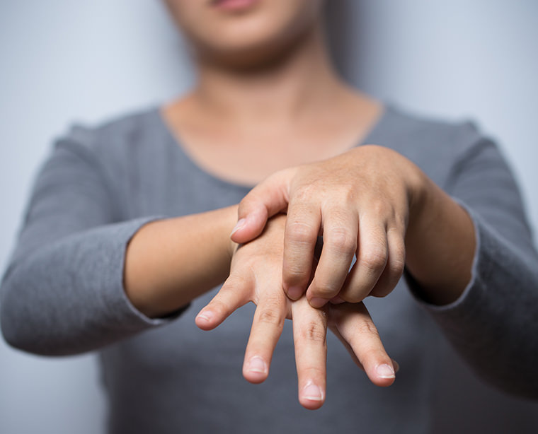 El eczema de las manos
