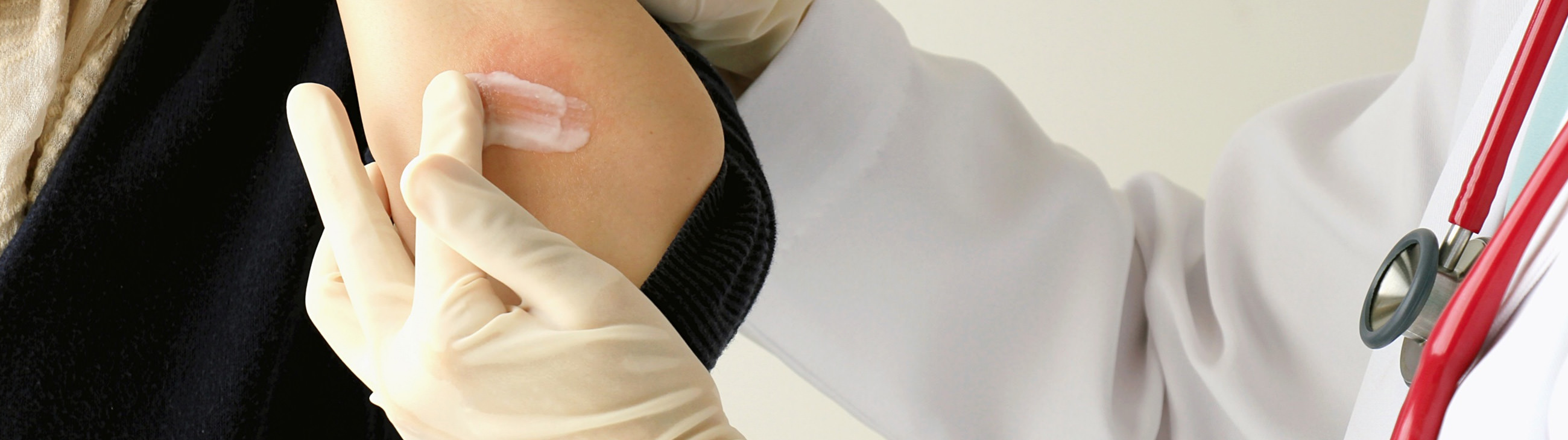 Os tratamentos para tratar o eczema