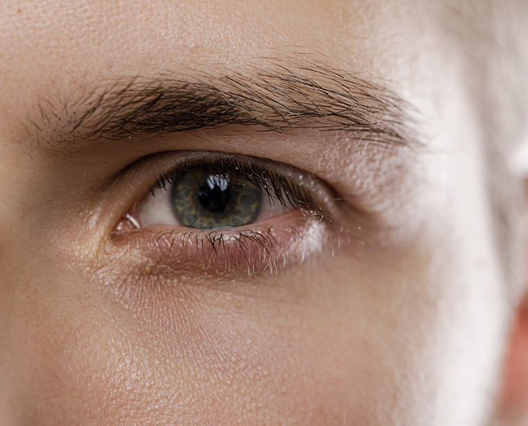 El eczema de los ojos 