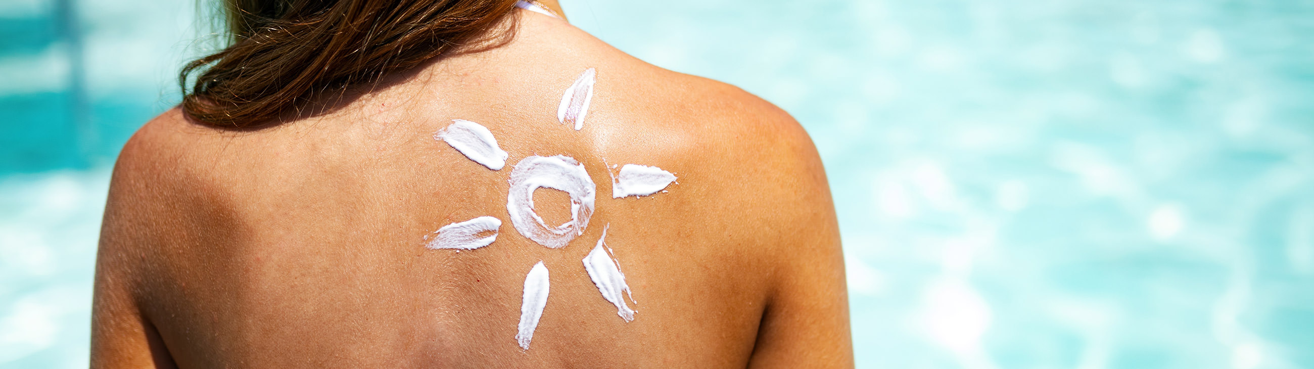 ¿El sol es bueno para el eczema atópico?