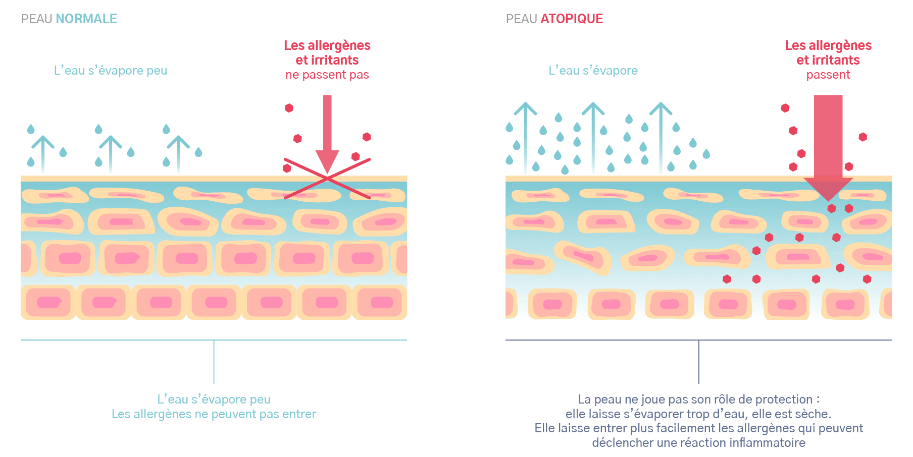 La cause fondamentale : une peau atopique