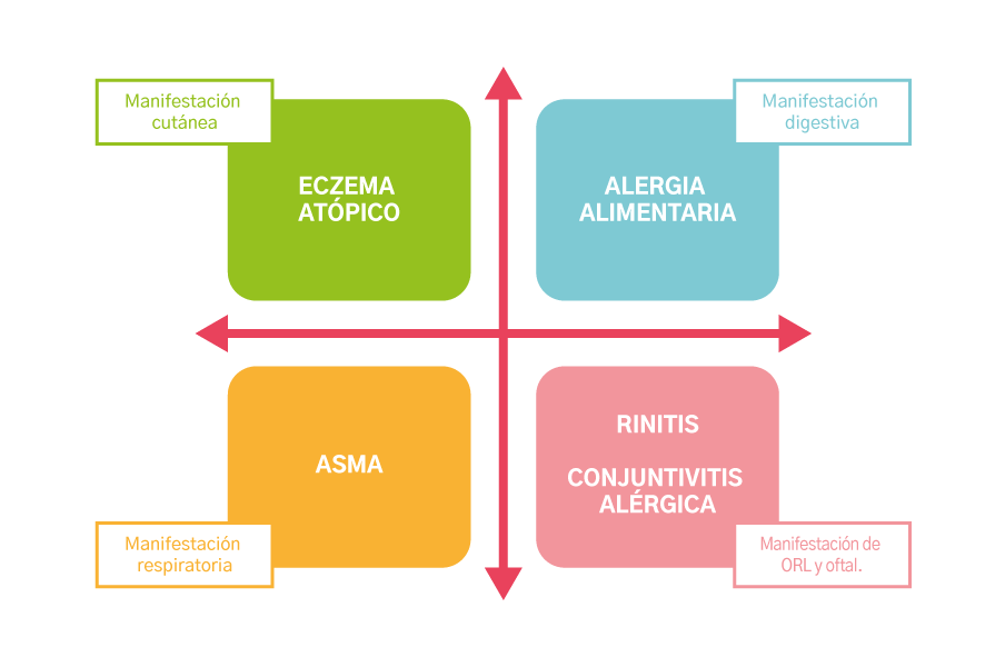 La atopia puede manifestarse de diferentes maneras