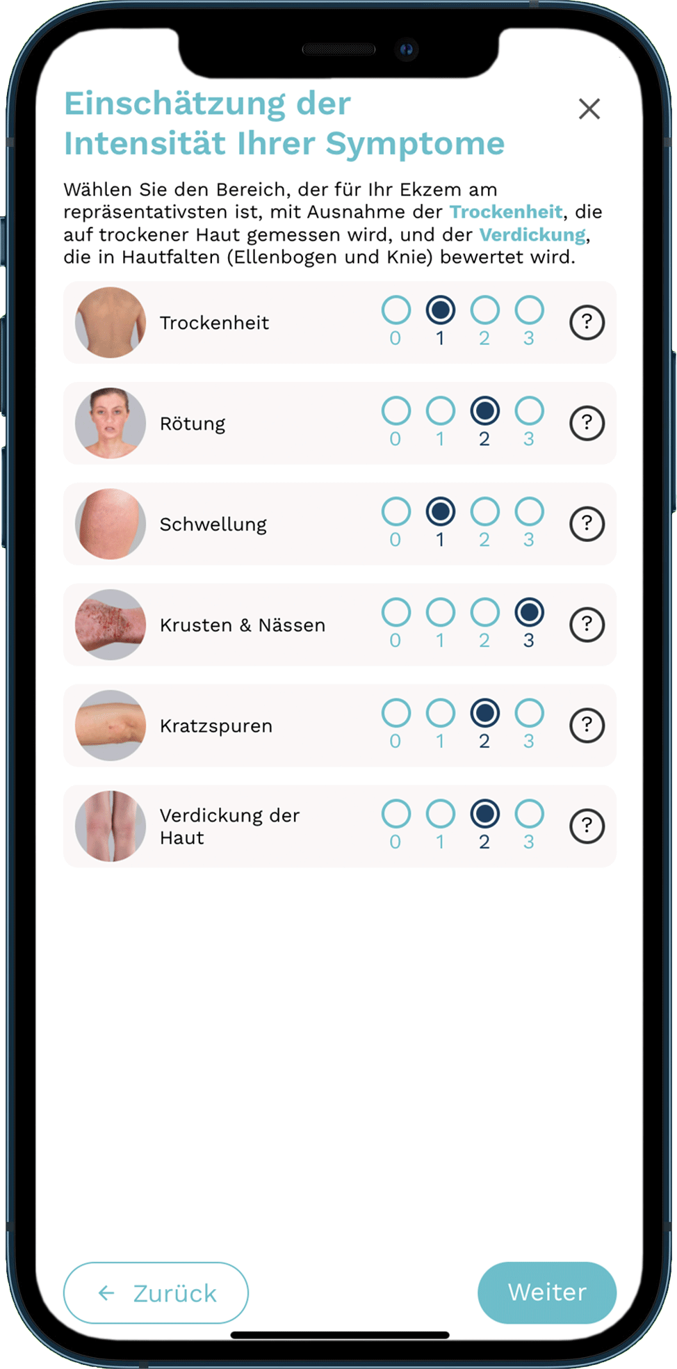 Beobachtete Symptomstärke