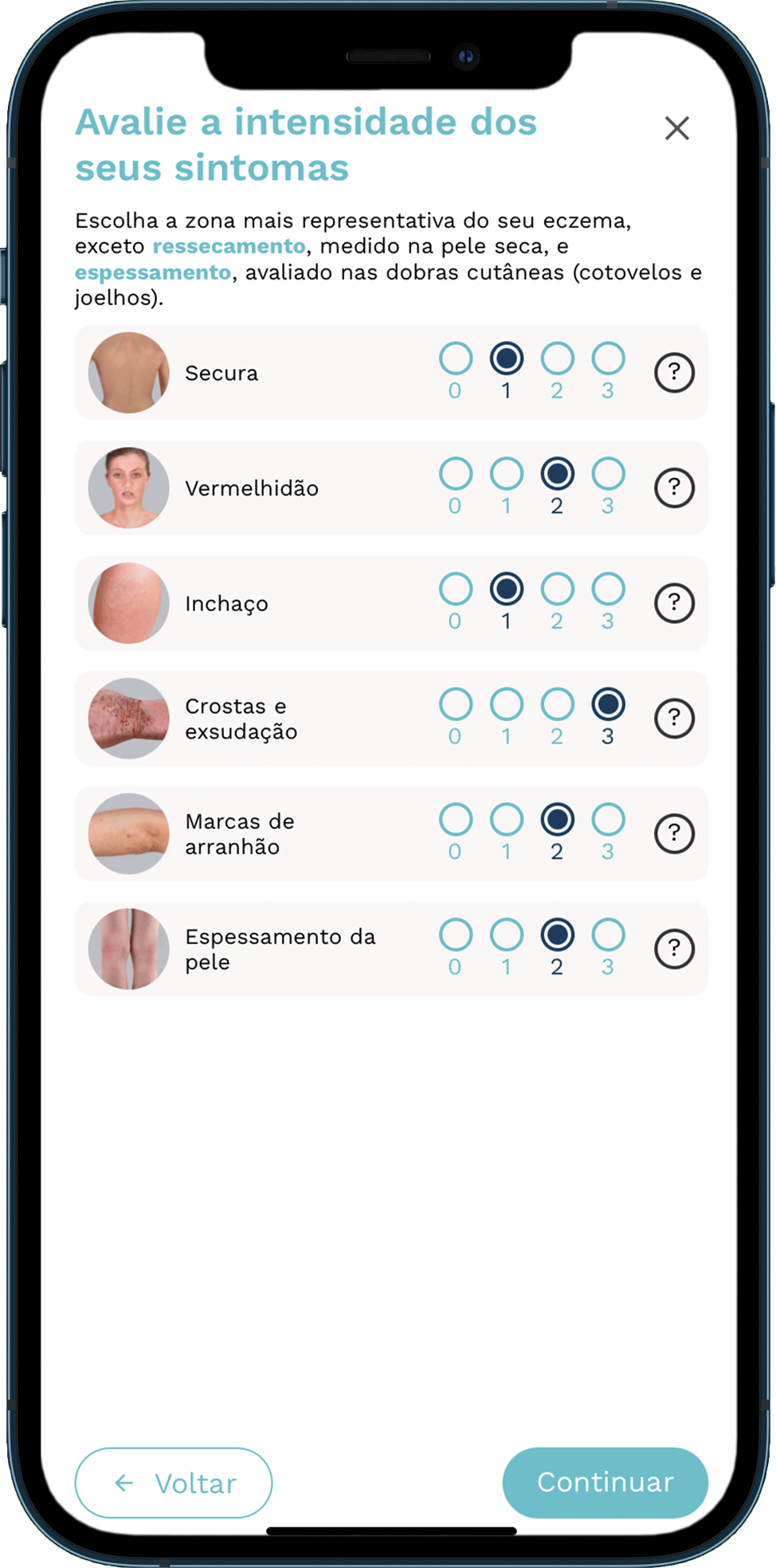 Intensidade dos sintomas observados