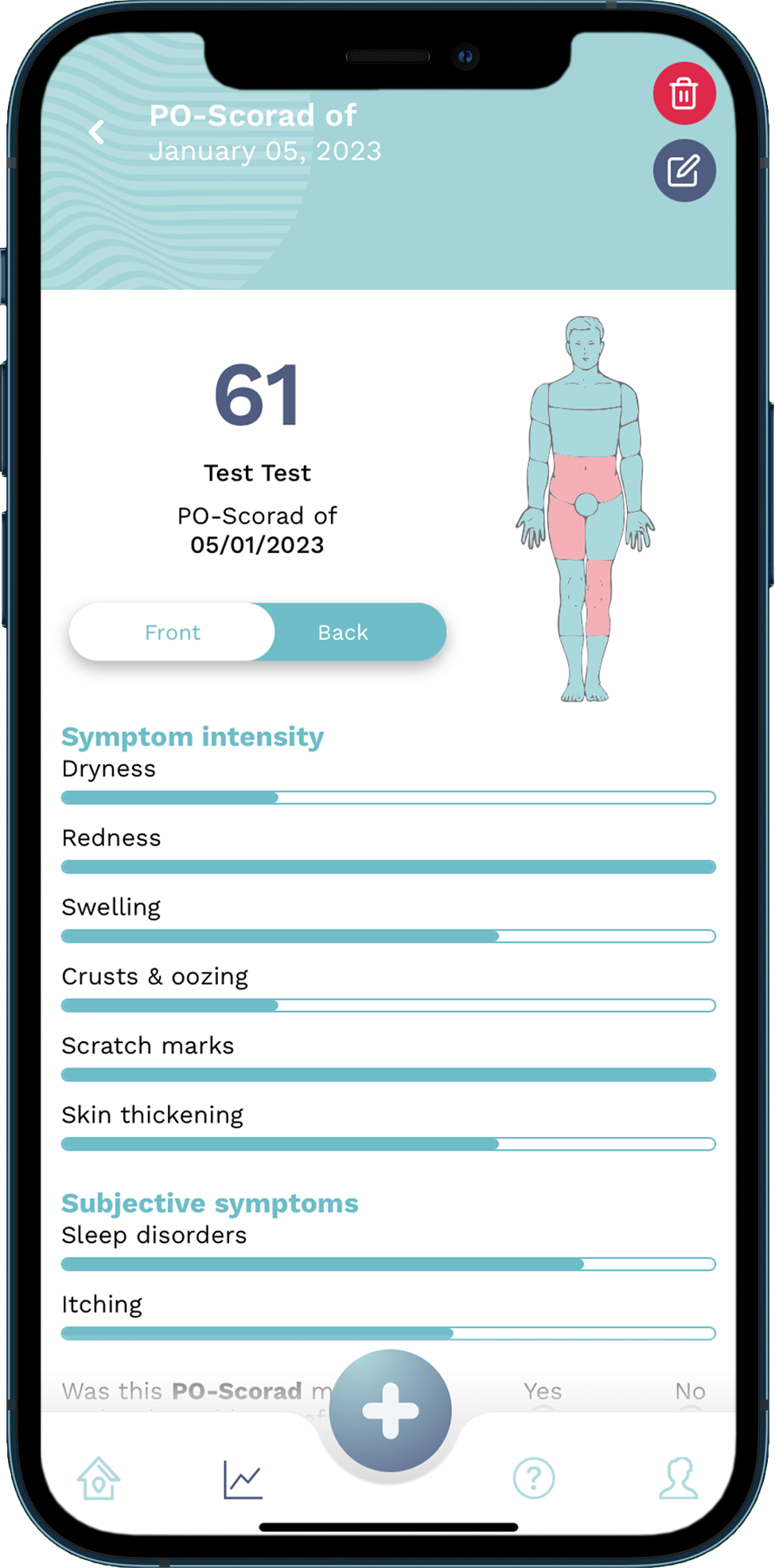 Surface area of skin affected