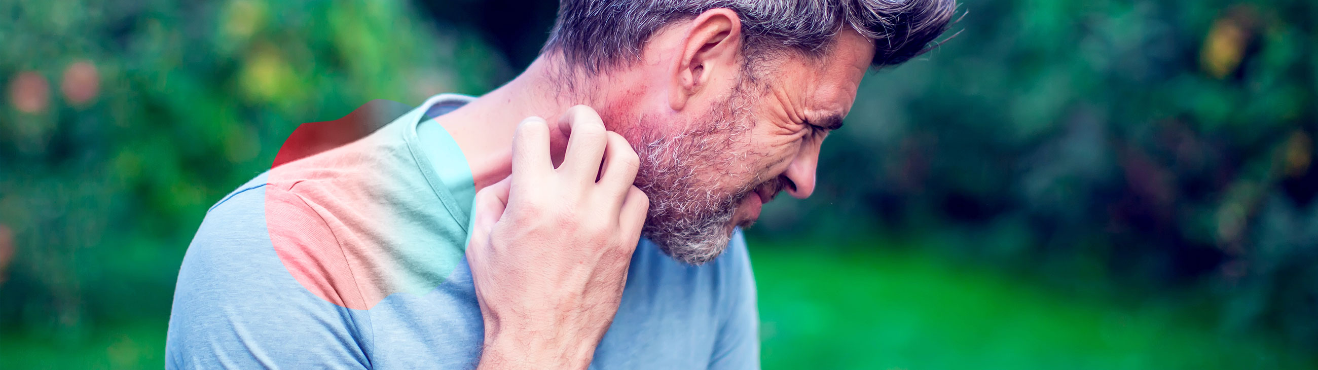 Est-ce de l'eczéma ou l'urticaire