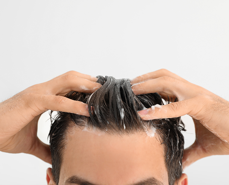 Dermatitis in Hair or Skin Disease on the Head Stock Photo  Image of skin  hair 78069730