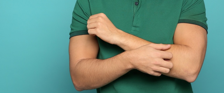 Eczema versus psoriasis: how to tell the difference