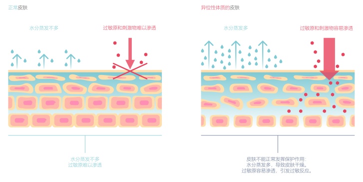 皮肤屏障