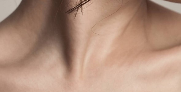 eczema atopique
