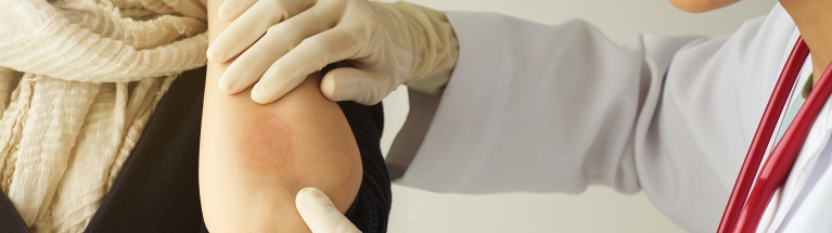 Est-ce bien de l'eczéma ?